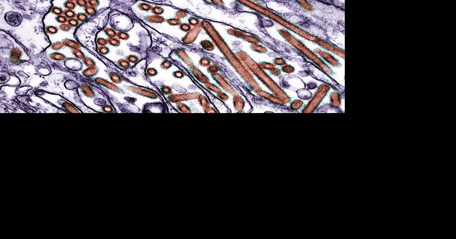 Avian flu quarantine hits turkey farm in Daviess County