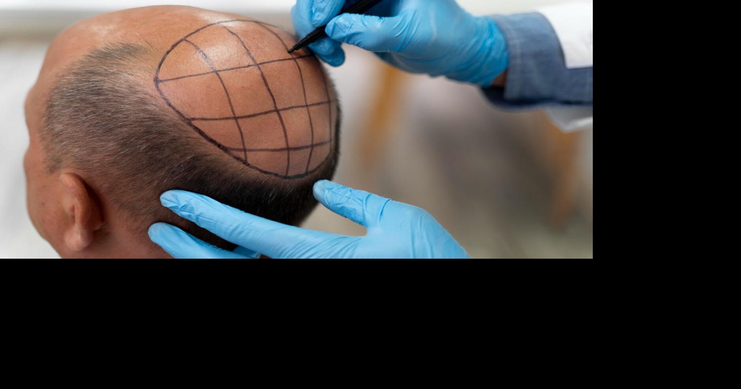 Turkey's Top 10 Hair Transplant Clinics in 2026: A Buyer's Guide to Getting It Right the First Time
