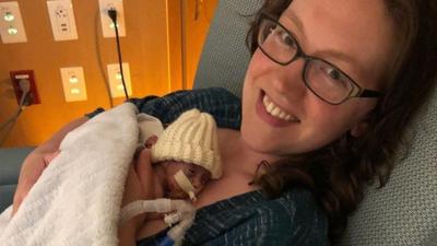 Feeding Preemies Better: How Advances in NICU Nutrition Have Been Helping Babies Thrive