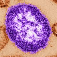 West Virginians may have been exposed to measles at Dulles Airport in D.C.