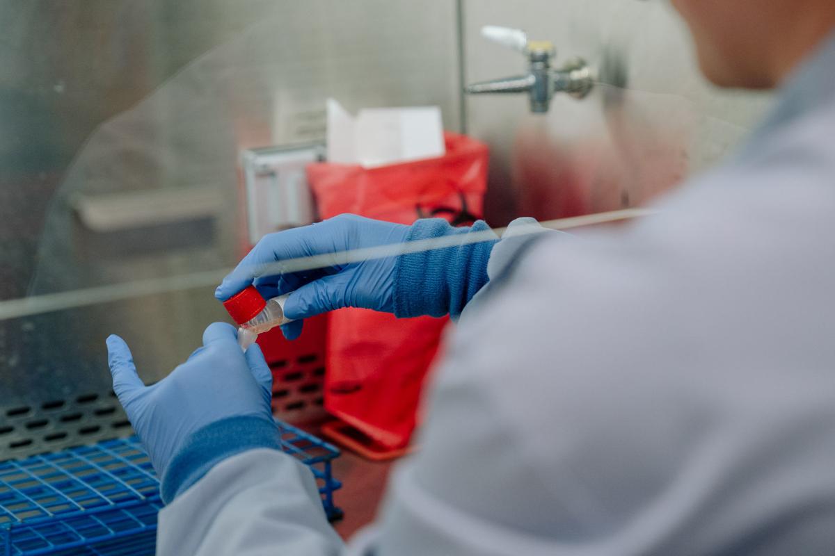 States Pivot Away From Private Labs As Backlog Of Covid 19 Testing Results In Long Wait Times Coronavirus Wvgazettemail Com