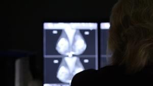 La Crosse Report Highlights Rising Breast Cancer Diagnoses Among Younger Women