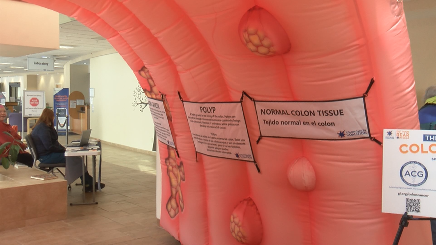 Winona Health brings giant colon exhibit for colon cancer
