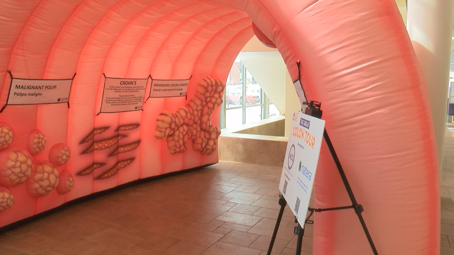 Winona Health brings giant colon exhibit for colon cancer