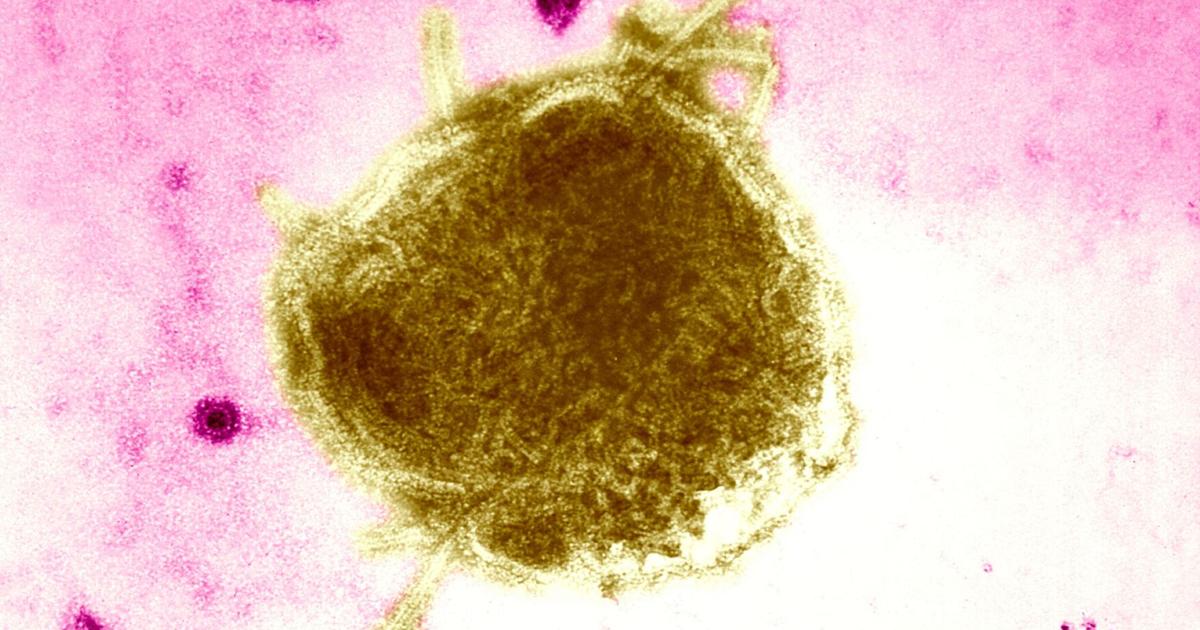 Wisconsin DHS confirms five additional cases of measles in Oconto County