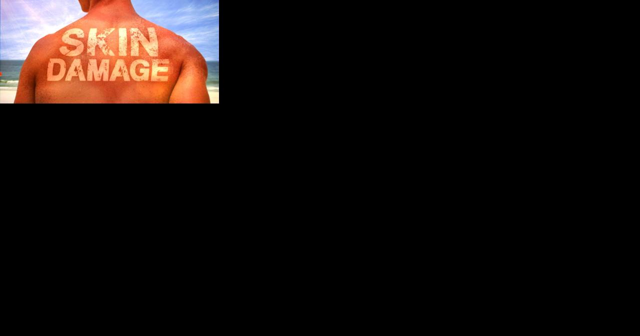 Medical Monday: Preventing skin cancer - Vimarsana News