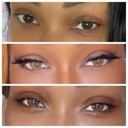 American Academy of Ophthalmology warning