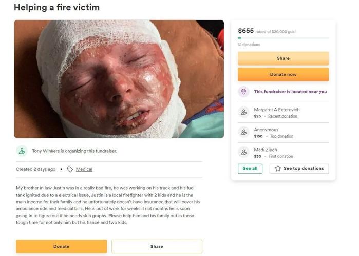 GoFundMe for Baraboo burn victim