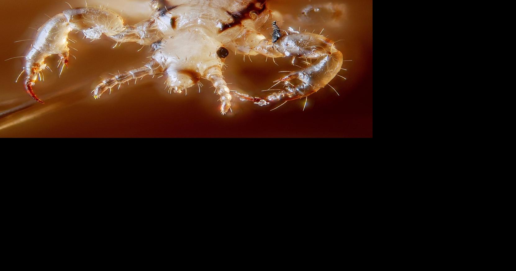 L is for Lice They're not going away anytime soon Local