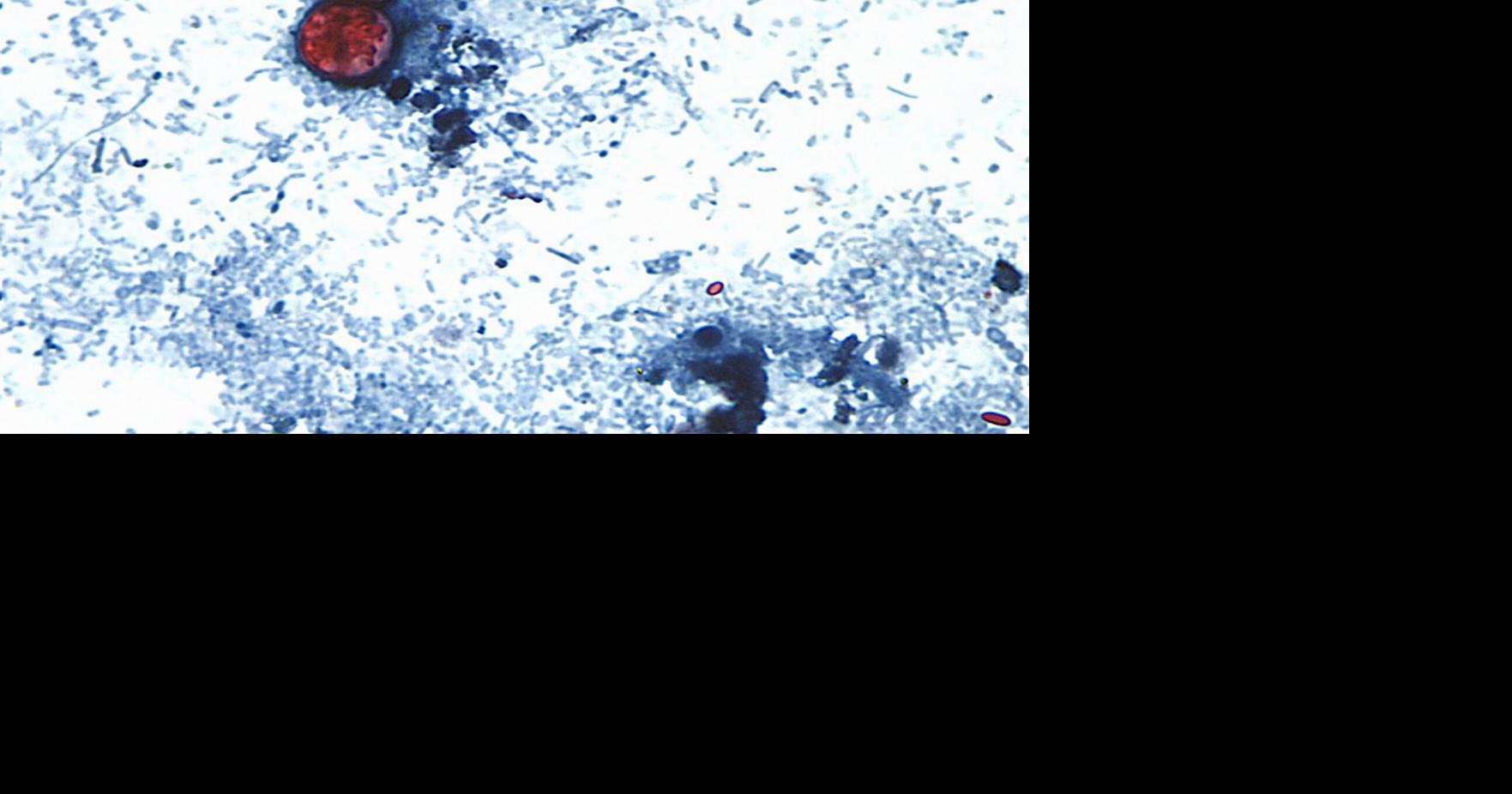 Cyclospora outbreak followed years of declining FDA foreign inspections By MATTHEW PERRONE AP Health Writer Sep 8, 2026 Sep 8, 2026 Updated 3 mins ago