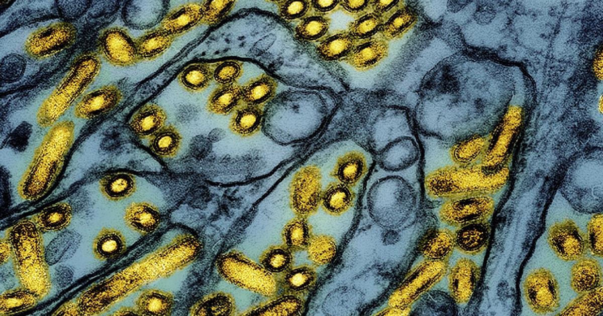 Backyard flock tests positive for bird flu in Yakima County | Local ...