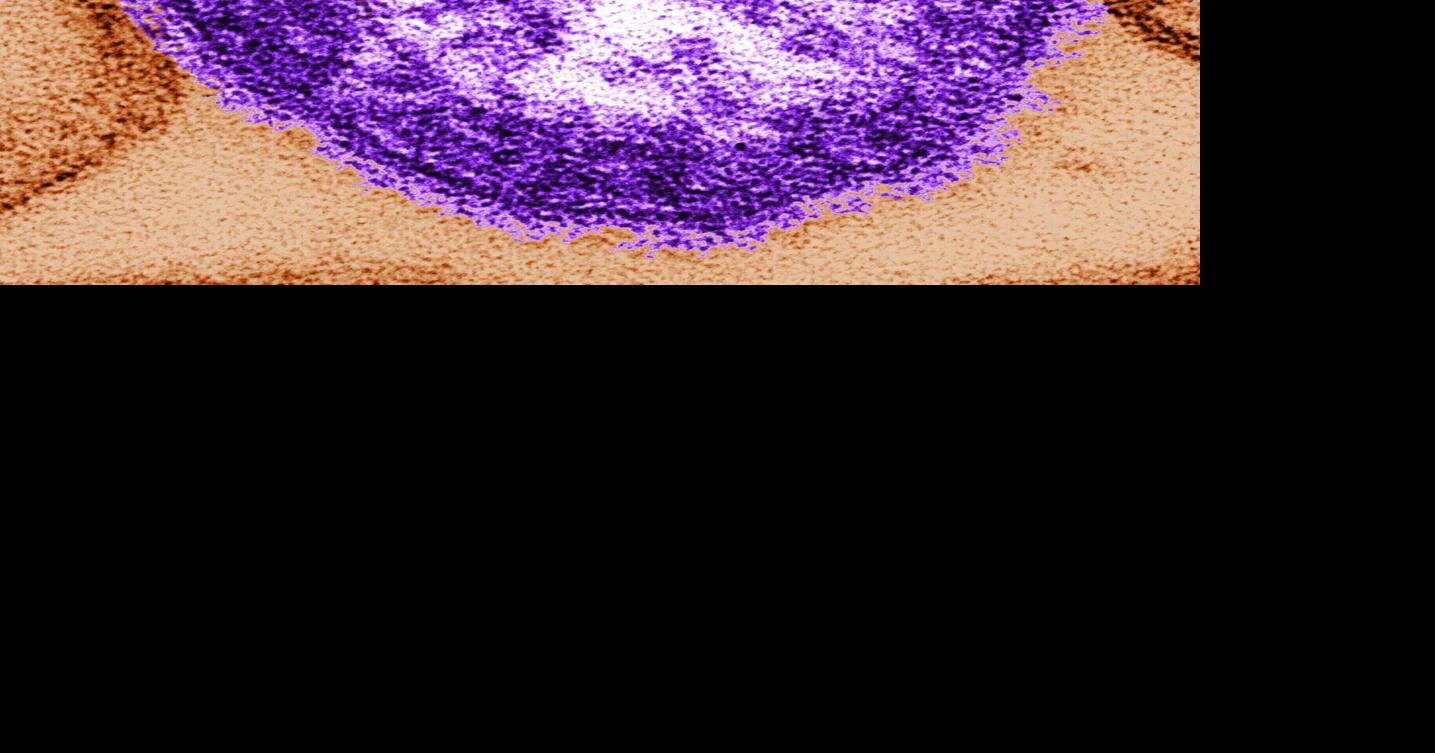 Visit from South Carolina family with measles leads to alert in WA