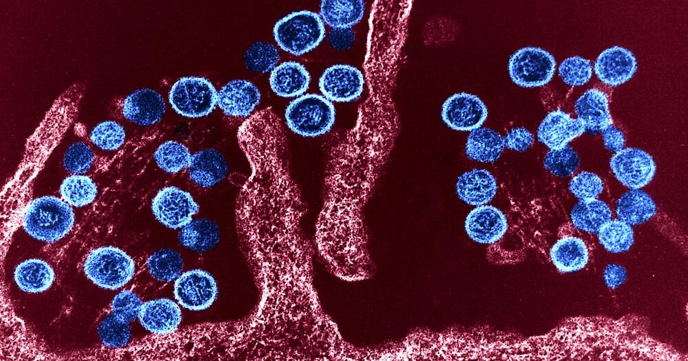 Grant County Resident Dies from Hantavirus - Vimarsana News