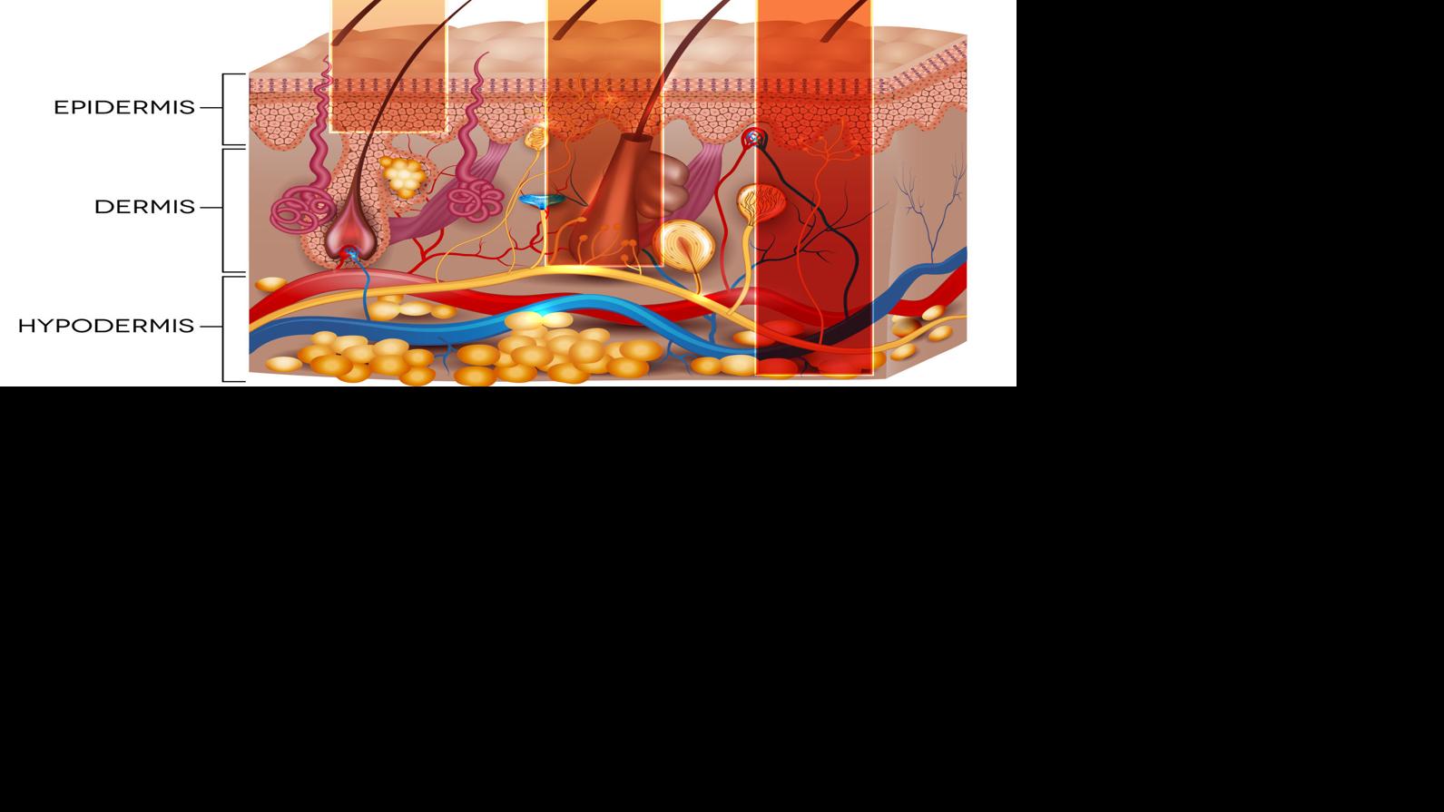 Burn Awareness And Treatment Options Feeling Fit Yoursun Com
