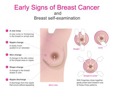 Breast Cancer Signs And Symptoms Feeling Fit Yoursun Com