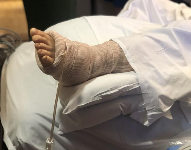 Hospitalized man bitten by rattlesnake in North Port undergoes
