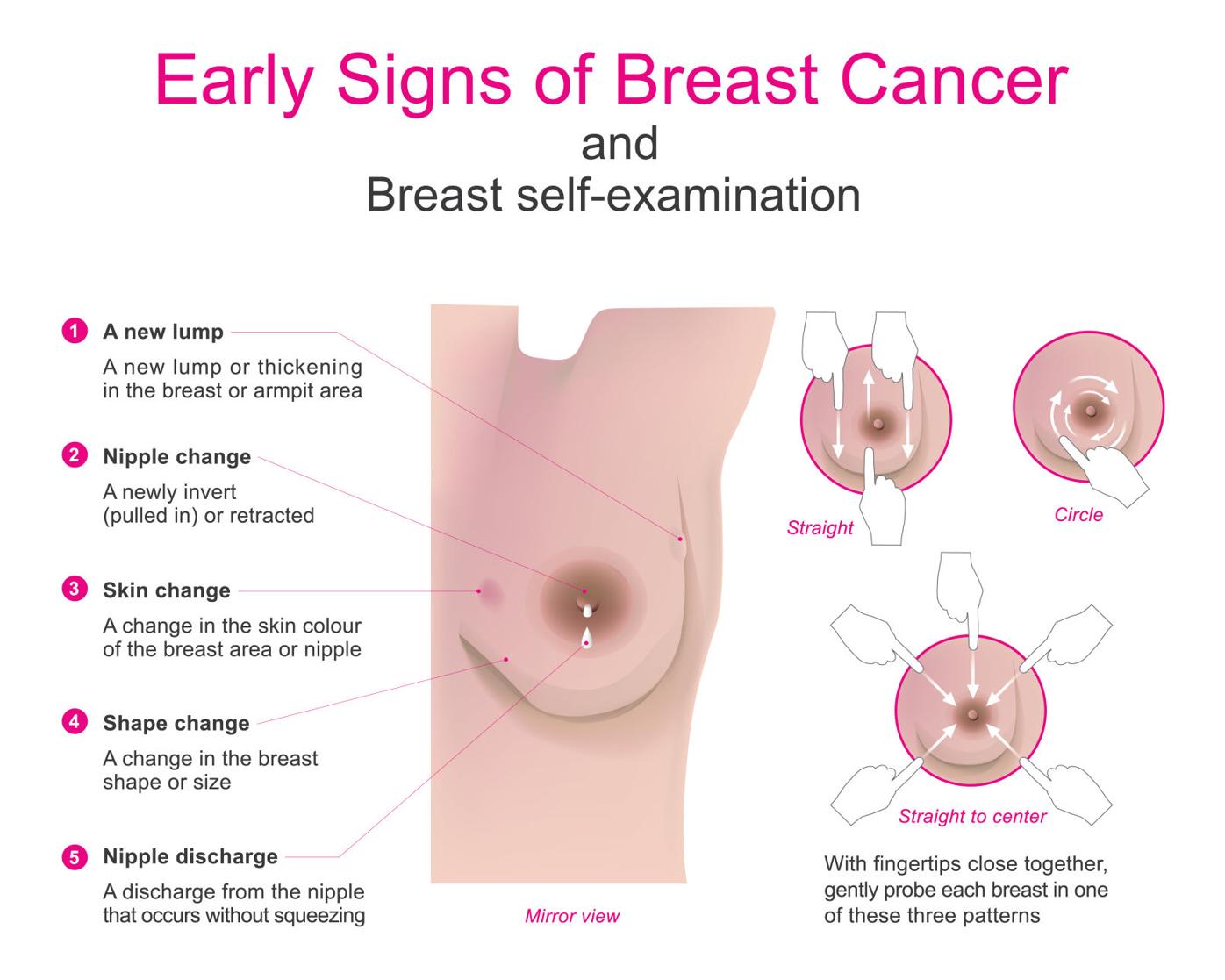 Early warning signs for breast cancer, Feeling Fit