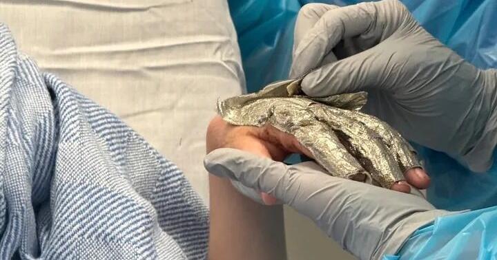 Boy injured in school treadmill accident faces long recovery; family seeks support